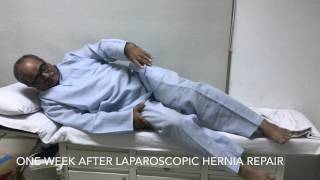 Recovery after Laparoscopic Hernia Repair [upl. by Notlih584]