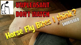 170723 Horse Fly Bites I think SHORTENED [upl. by Ariane]