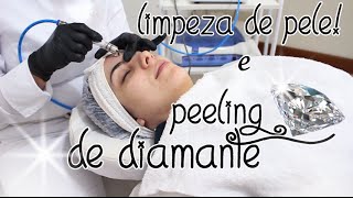 Benefícios do PEELING DE DIAMANTE e LIMPEZA DE PELE [upl. by Yud]