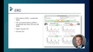 RETeval Case Study Routine ERG Use Supports Patient Management Bradley Grant OD [upl. by Ellennod]