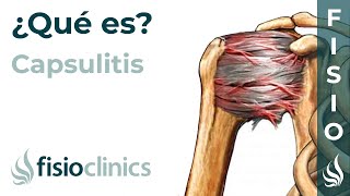 Cápsula articular y capsulitis ¿Qué es  FisioClinics Palma de Mallorca [upl. by Beverie]