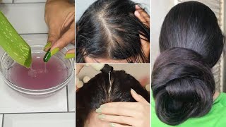 30 Days Double Hair Growth Hacks पतले बालों में 1 बार लगाओ हैरान हो जाओगे बाल होंगे इतने मोटे घने [upl. by Hnao]