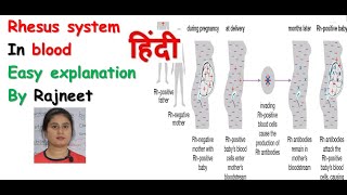 Rhesus system in hindi  Rh incompatibility  haemolytic disease  Rj medical education [upl. by Antonina]