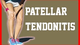 Patellar Tendonitis Ultrasound Iontophoresis  Patellar Tendonitis  NEObracex [upl. by Lyrradal]