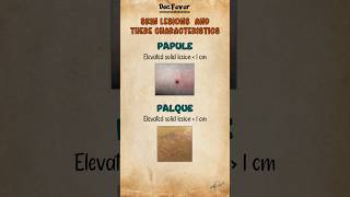 Skin lesions and there characteristics skincareskindermatologylesion medicalvideosmbbsshort [upl. by Phia]