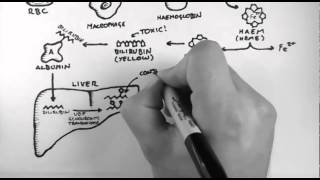 Bilirubin 1  Bilirubin Pathway [upl. by Thurber997]