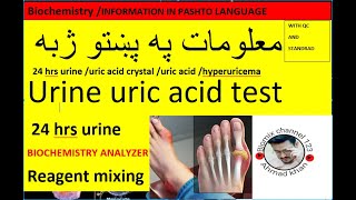 Urine uric acid testuric crystaluricase pap methoduric acid synthesisstone in pashto [upl. by Cence]