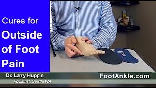 How to Treat Pain on the Outside of the Foot with Seattle Podiatrist Dr Larry Huppin [upl. by Kreitman422]