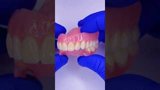 Look at these prostheses Upper acrylic and lower flexible mrdent dentist smile protesisdental [upl. by Htebarual]