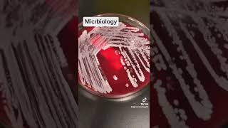 catalase test in microbiology [upl. by Broeker]