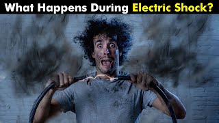 What Happens To Your Body When You Get Electric Shock  Electrical Injury UrduHindi [upl. by Ellegna272]