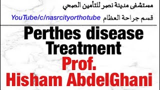 Perthes disease Treatment Prof Hisham AbdelGhani nasrcity online 2020 [upl. by Menedez124]