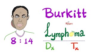 Burkitt’s Lymphoma  Diagnosis and Treatment  NonHodgkins Lymphoma  Aggressive Neoplasm [upl. by Sinnaiy]