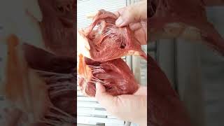 HUMAN HEART  CARDIOLOGISTS  HEART SURGEONS  DOCTORS  VENTRICLES  AURICLES  MBBS  BIOLOGY [upl. by Kancler]