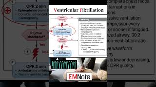 Ventricular Fibrillation VFib [upl. by Rotow]