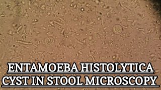 Entamoeba Histolytica Cyst under stool microscopy MLT WORLD [upl. by Cirri]