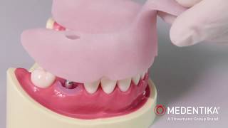 Mastering Precision Closed Impression Technique with MEDENTiKA® Microcone Implant 🌐🦷 [upl. by Yllaw]