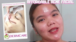 AFFORDABLE ACNE FACIAL TREATMENT  DERMCARE [upl. by Eustashe]