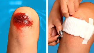 SAFETY HACKS AND FIRST AID 😰  TRUQUES DE PRIMEIROS SOCORROS  Dicas DIY e Situações Divertidas [upl. by Jared976]