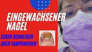 Eingewachsener NagelAbstand halten [upl. by Yeltneb]