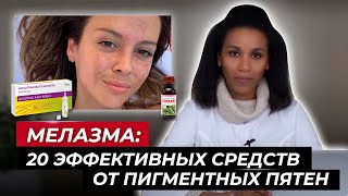 Как избавиться от мелазмы Лучшие средства от пигментации Избавься от пигментных пятен [upl. by Derby]