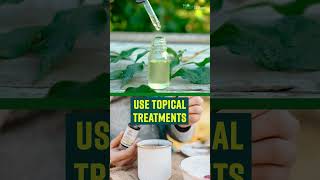 How To Treat Boils At Home   Home Remedies [upl. by Irrol]