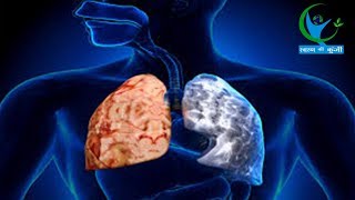 क्या है COPD बीमारी और इसका इलाज  देखें video में  What is COPD And Its Remedies [upl. by Anorahs]