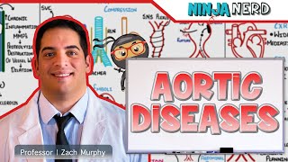 Aortic Diseases  Clinical Medicine [upl. by Spanjian93]