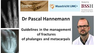 Guidelines in the management of fractures of phalanges and metacarpals [upl. by Latia]