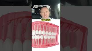 Czy Usuwanie Ósemek Boli 😳😱 Animacja 3D Dentystyczna [upl. by Ahslek]