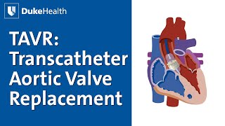 TAVR Transcatheter Aortic Valve Replacement Explained  Duke Health [upl. by Appledorf173]