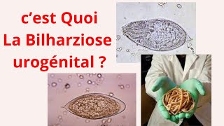 CEST QUOI LA BILHARZIOSE UROGENITALE [upl. by Arrakat]