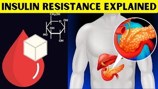 Insulin Resistance Explained What Is Insulin Resistance amp How It Leads To Type II Diabetes [upl. by Radnaxela]