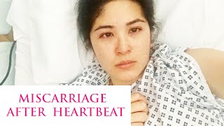 First Pregnancy Miscarriage after Heartbeat Multiple Fibroids  Sam Loves [upl. by Schacker]