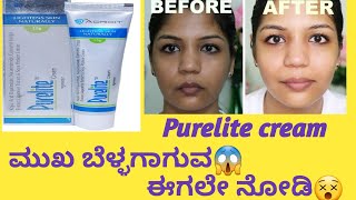 Purelite cream information in kannadaUsesside effects healthcare595 viral skincareroutine [upl. by Leziar109]