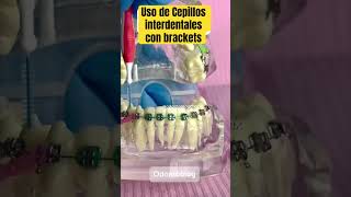 Cepillos interdentales con brackets shorts brackets bracket cepillosinterdentales ortodoncia [upl. by Ahtnamas]