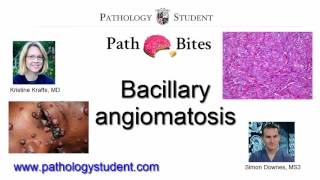 Path Bites  Bacillary angiomatosis [upl. by Leinto]