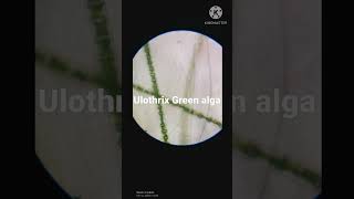 Microscopic structure of ulothrix green algae [upl. by Meijer]