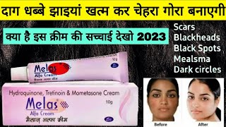 melas melas cream review  pigmentation  blemishes  dark spot  daag dabbe hatane wali cream [upl. by Iderf]