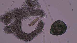 Amoeba hunts and kills paramecia and stentor to music by Lamar Genesis Winter Zimmer [upl. by Humpage]