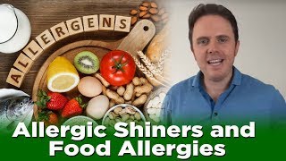 Allergic Shiners and Food Allergies  Dr J Q amp A [upl. by Ijar]