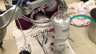 Oxygenator Changeout Medtronic Fusion [upl. by Pammi]