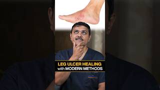 Revealed Innovative Ways to Heal LEG ULCERS Quickly legulcer shortsvideo vascularsurgeon [upl. by Primalia]