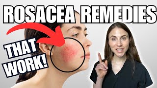 5 Rosacea Remedies THAT WORK  Dermatologist Tips [upl. by Htebiram]