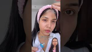 How to use tretinoin for hair growth bald patches hair thinning recedinghair line dermatologist [upl. by Clemmy]