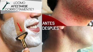 ¿CÓMO AFEITARSE HOMBRES  Consejos para evitar alergias después de rasurar [upl. by Hekking304]