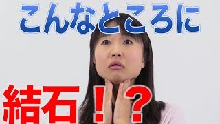 唾液腺にも結石ができる？ 口腔ケアチャンネル 1068（口腔ケアチャンネル2 ＃741） [upl. by Gahan]