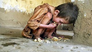 ABHINAV  Why Are Children Hungry [upl. by Tioneb771]