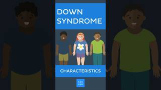 Down Syndrome Characteristics downsyndrome [upl. by Liagabba]