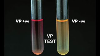 Voges Proskauer Test [upl. by Feenah]